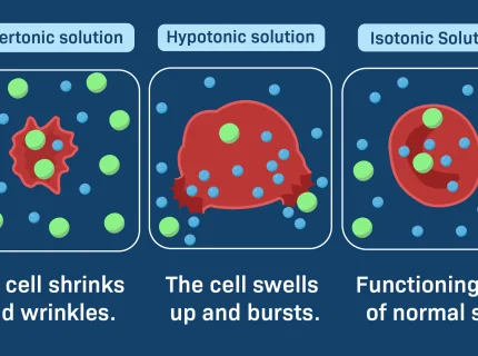 hypertonicity