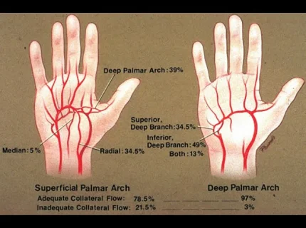 palmar