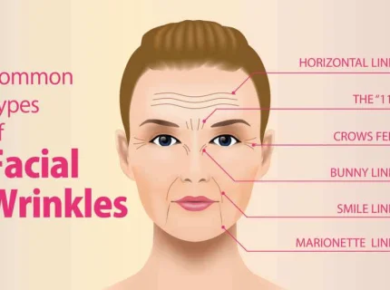 wrinkle