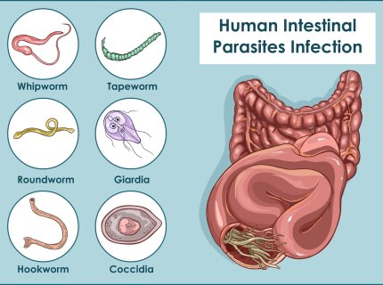 parasite