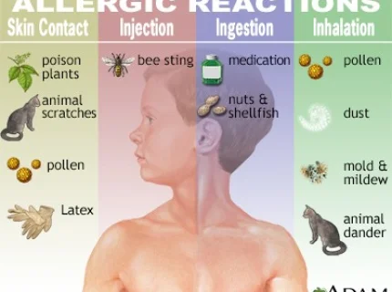 allergic