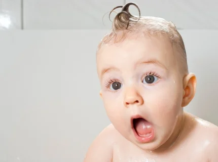 amazement