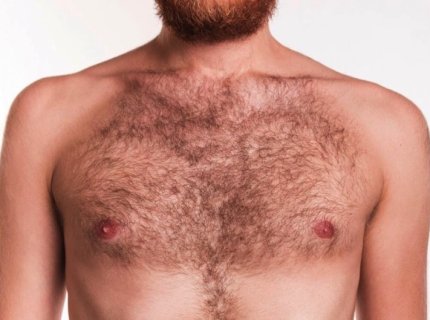 hairy